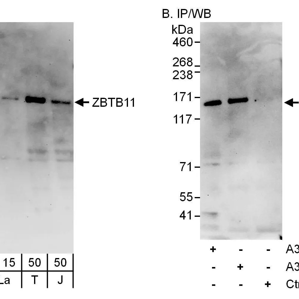 Rabbit anti-ZBTB11 Antibody, Affinity Purified