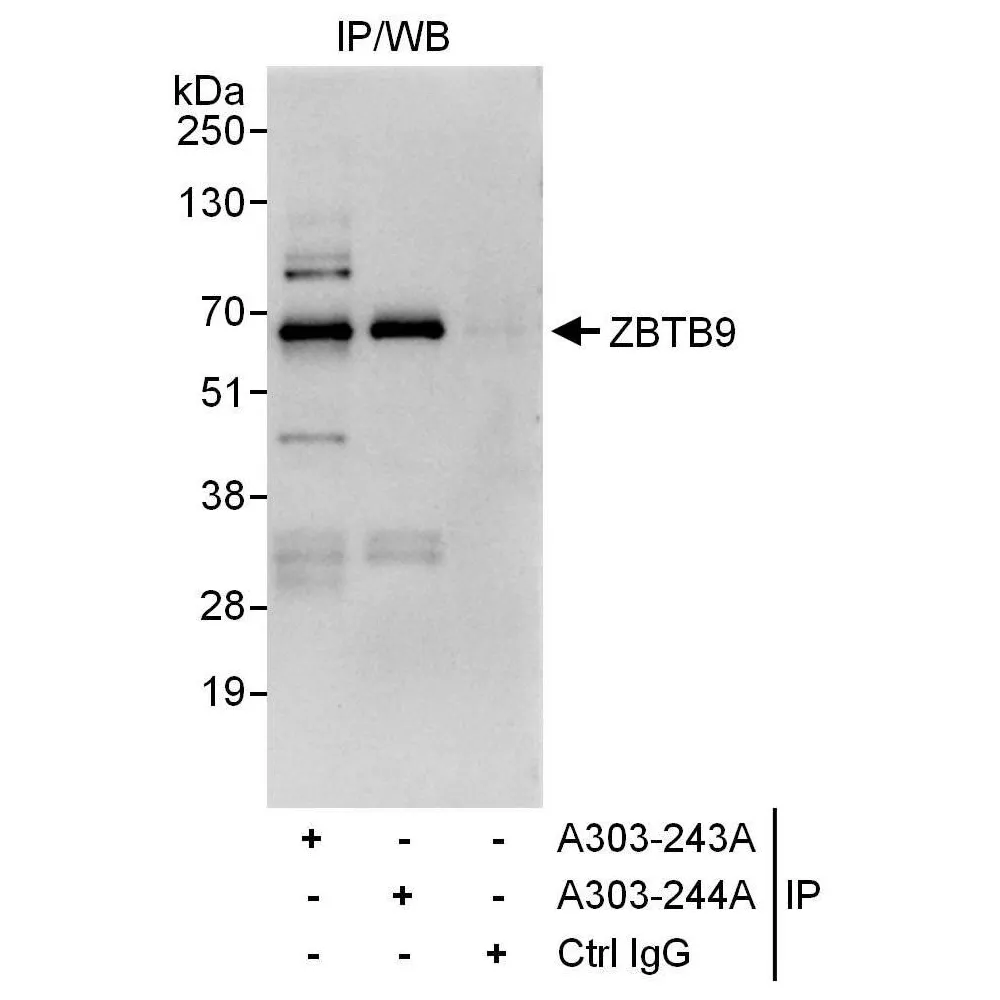 Rabbit anti-ZBTB9 Antibody, Affinity Purified