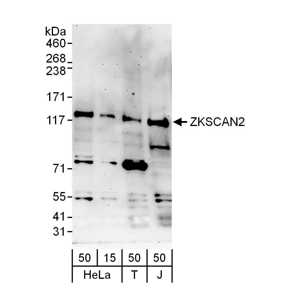 Rabbit anti-ZKSCAN2 Antibody, Affinity Purified