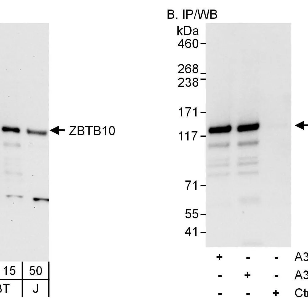 Rabbit anti-ZBTB10 Antibody, Affinity Purified