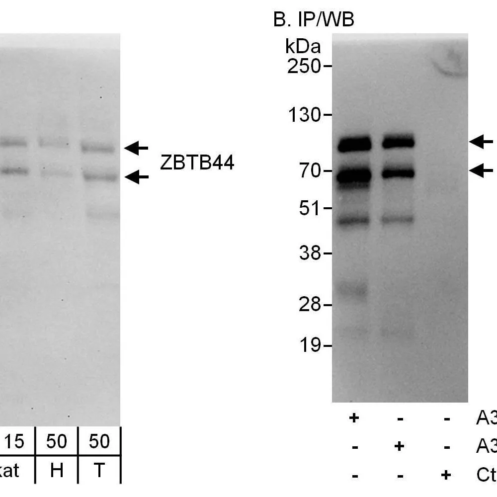 Rabbit anti-ZBTB44 Antibody, Affinity Purified