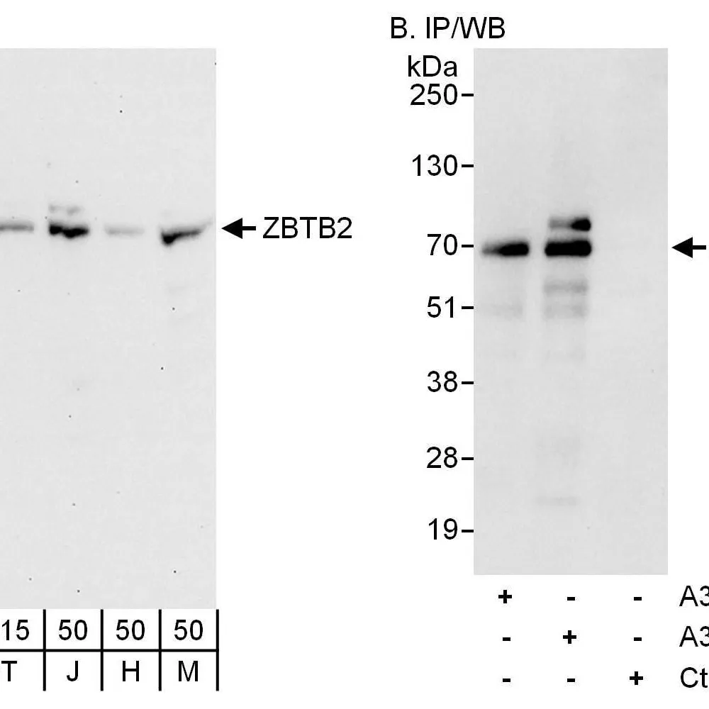 Rabbit anti-ZBTB2 Antibody, Affinity Purified
