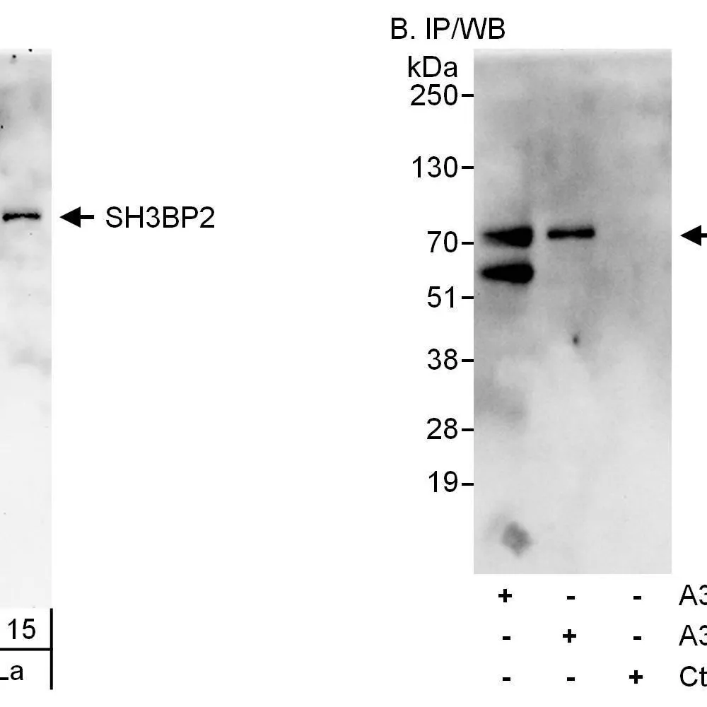 Rabbit anti-SH3BP2 Antibody, Affinity Purified