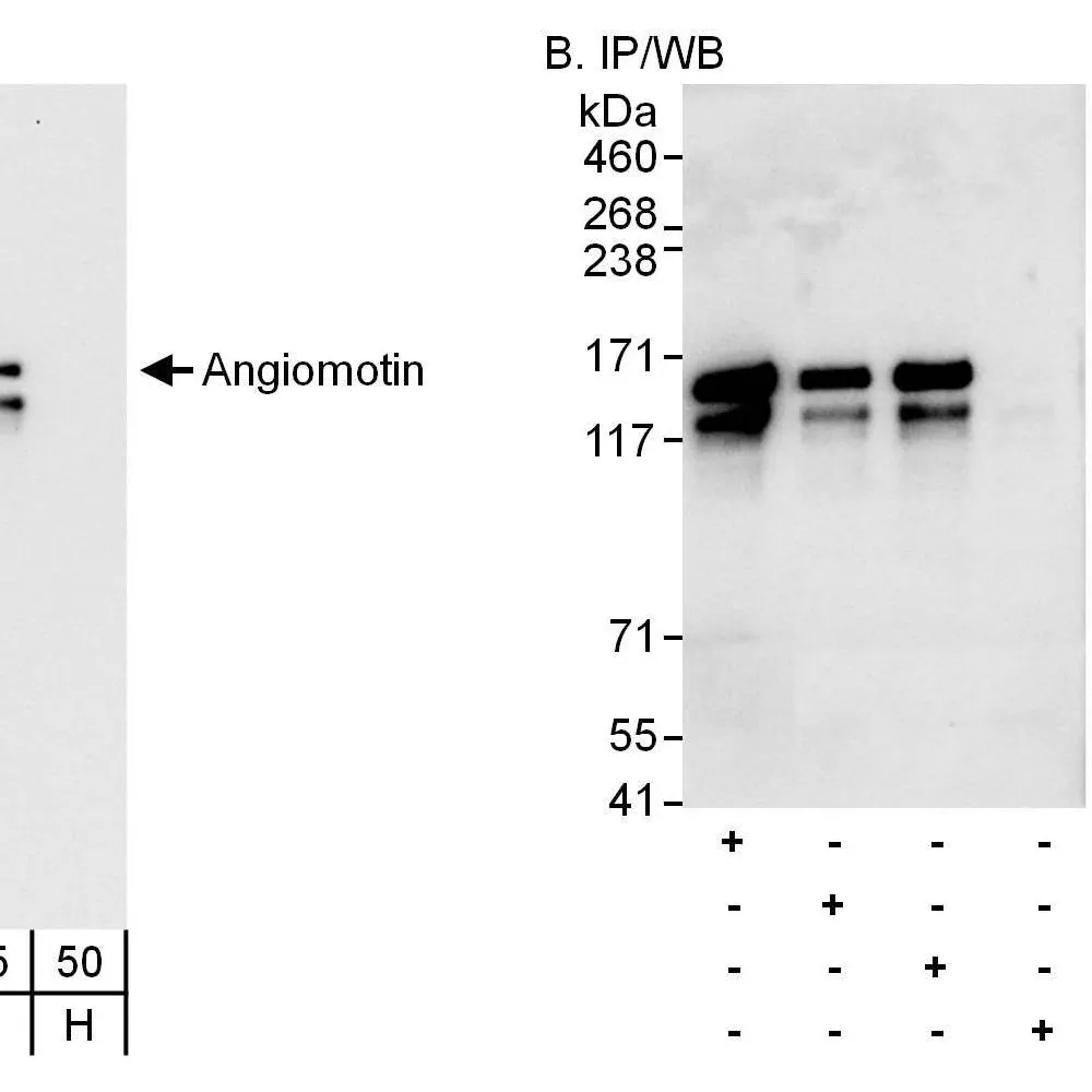 Rabbit anti-Angiomotin Antibody, Affinity Purified