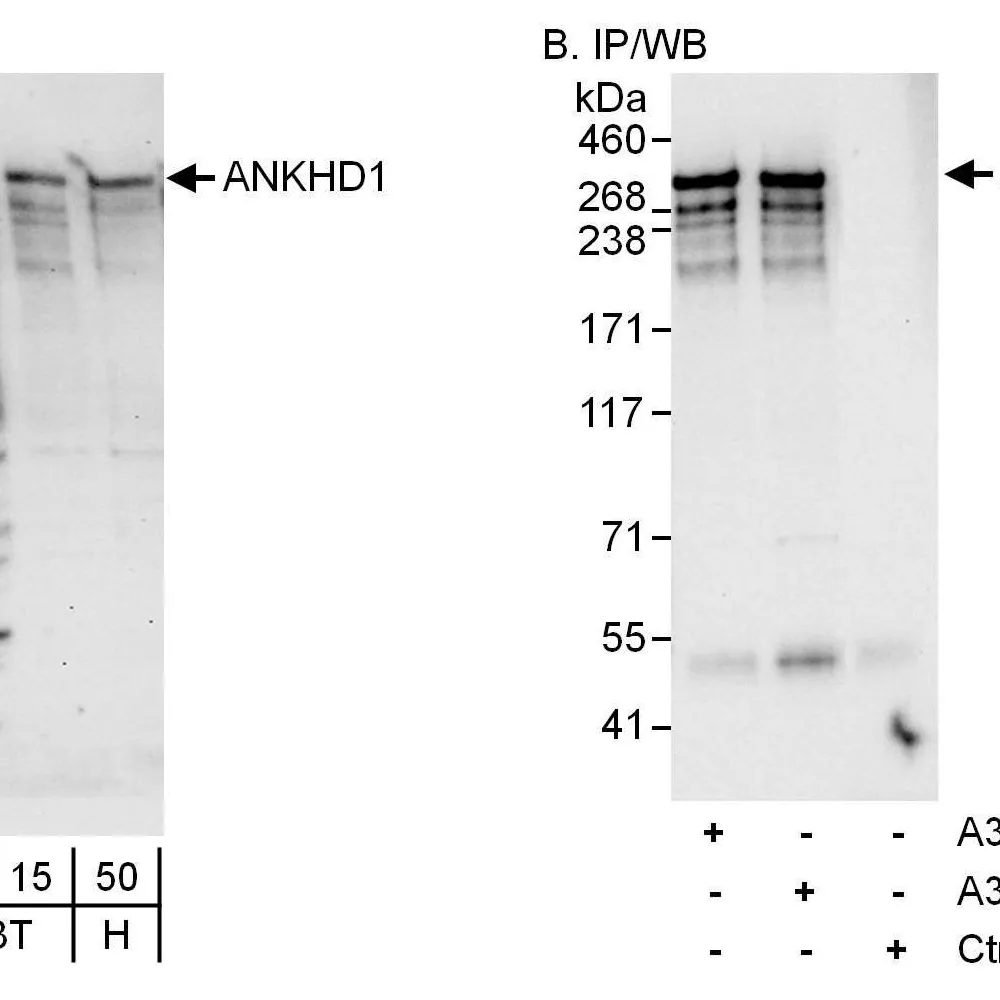 Rabbit anti-ANKHD1 Antibody, Affinity Purified