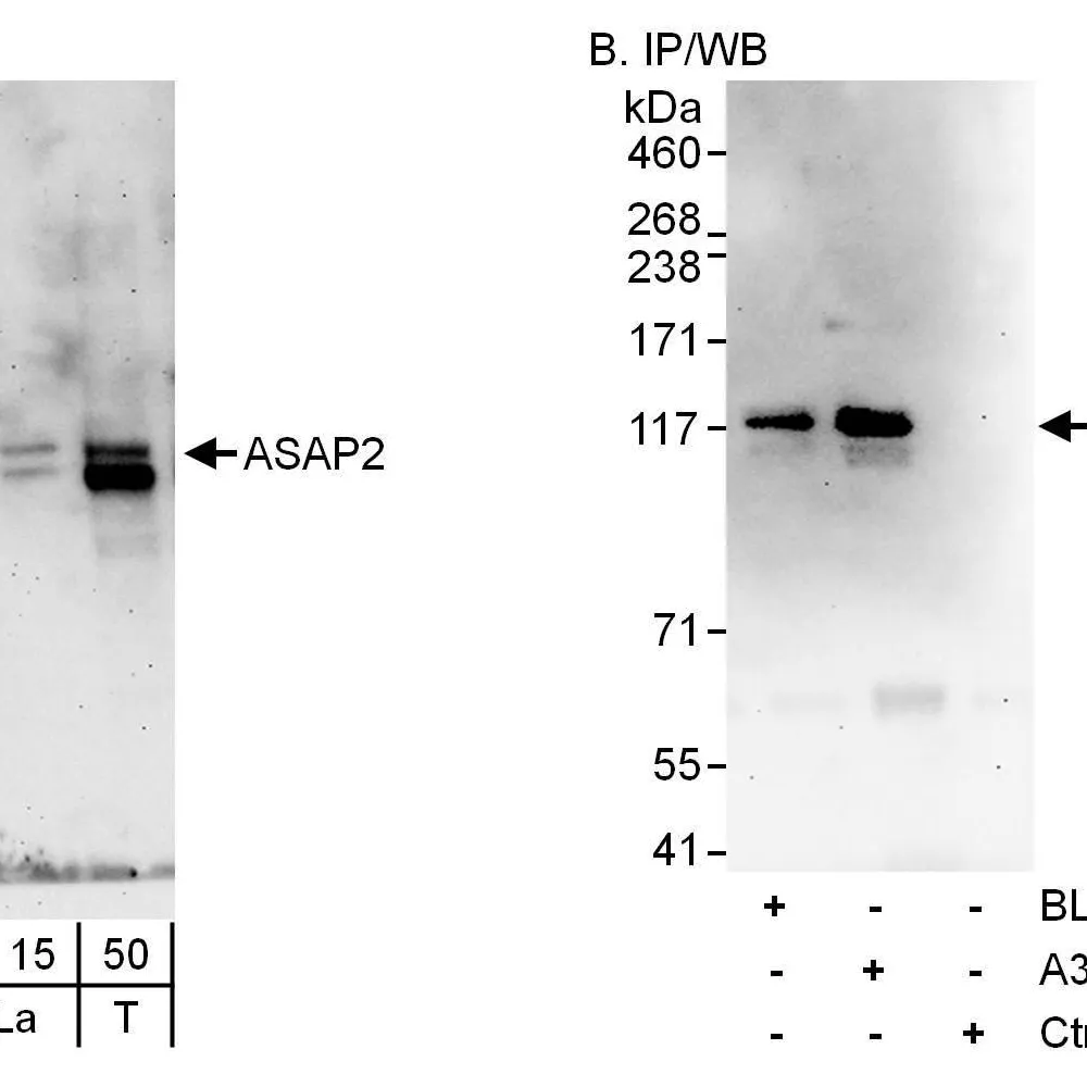 Rabbit anti-ASAP2 Antibody, Affinity Purified