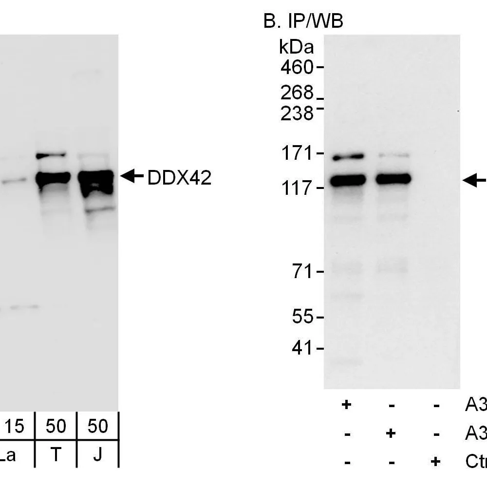 Rabbit anti-DDX42 Antibody, Affinity Purified