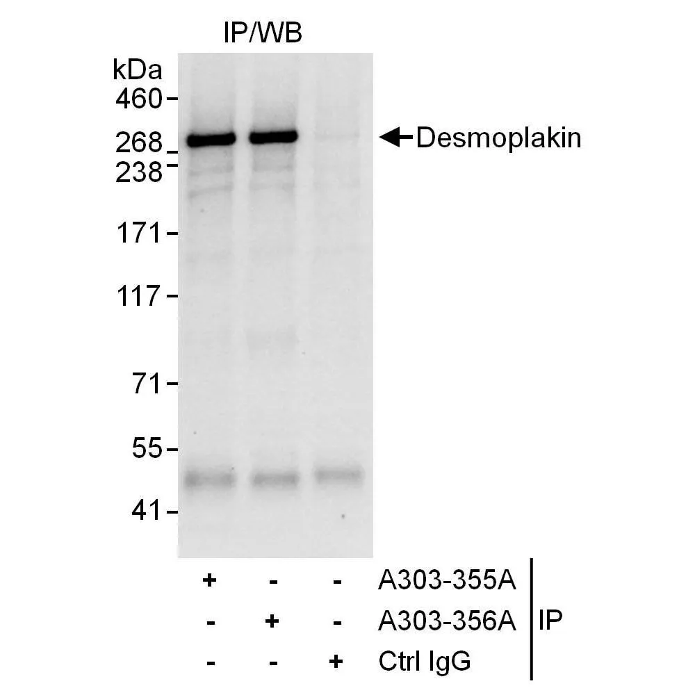 Rabbit anti-Desmoplakin Antibody, Affinity Purified