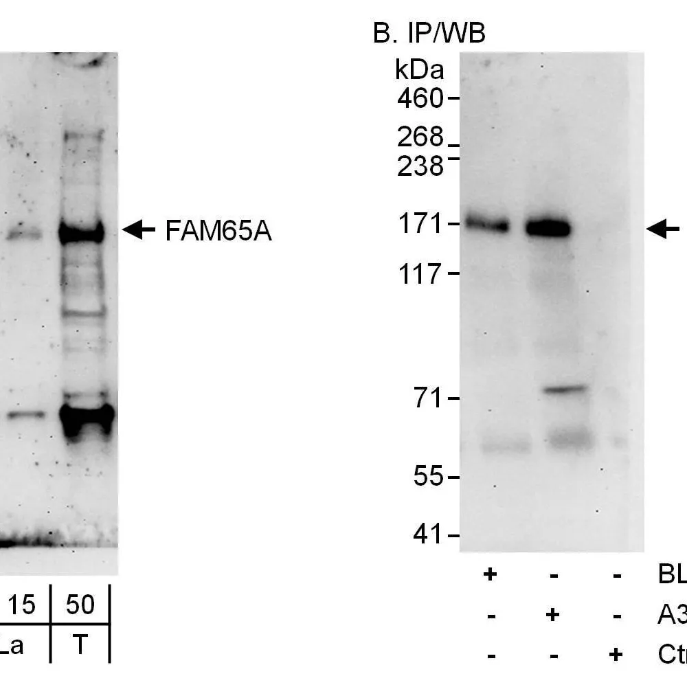 Rabbit anti-FAM65A Antibody, Affinity Purified