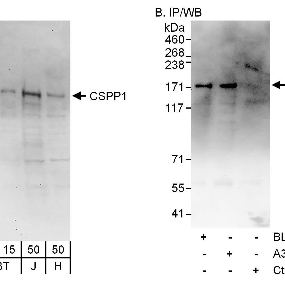 Rabbit anti-CSPP1 Antibody, Affinity Purified