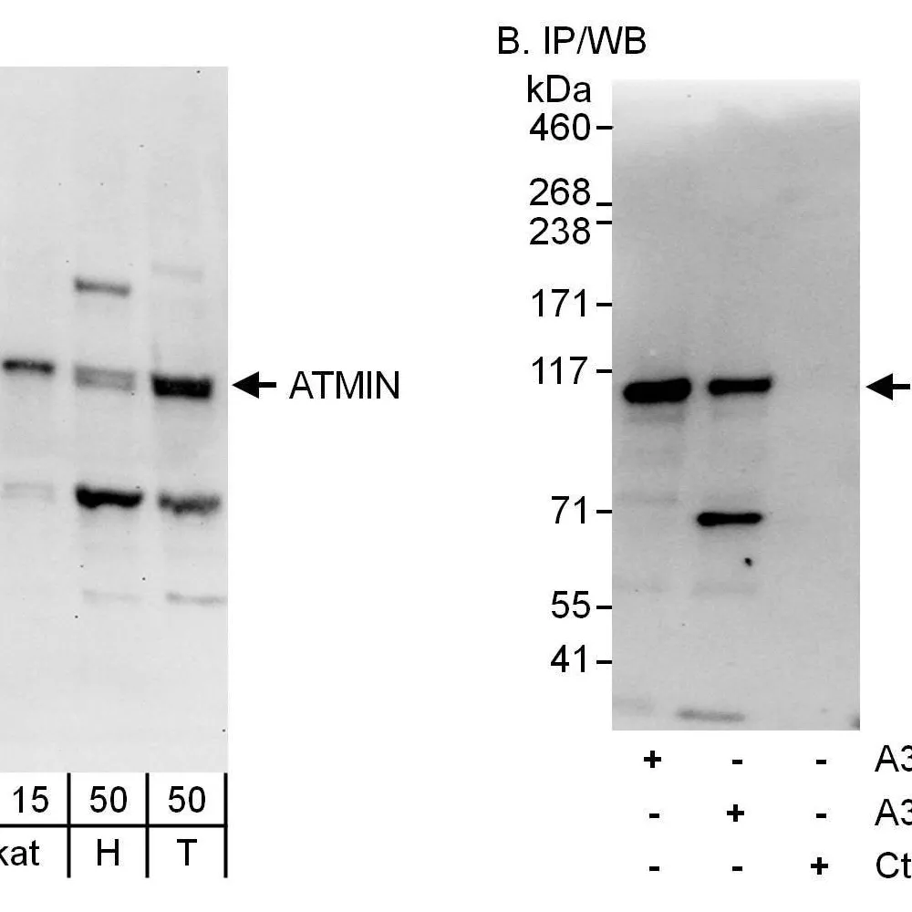 Rabbit anti-ATMIN Antibody, Affinity Purified