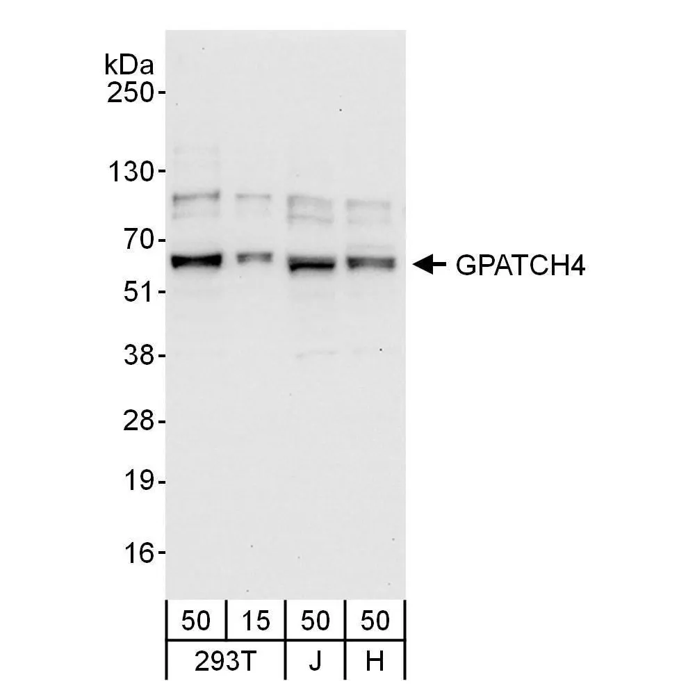 Rabbit anti-GPATCH4 Antibody, Affinity Purified