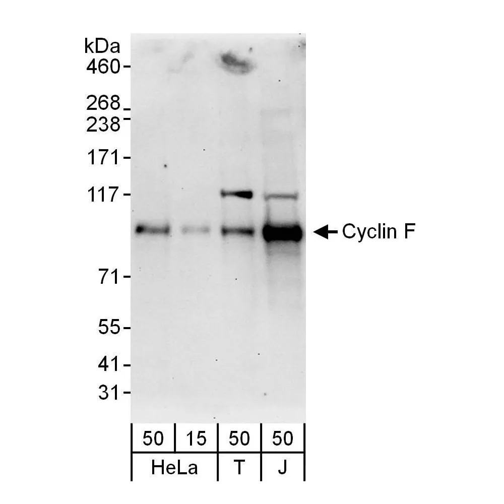 Rabbit anti-Cyclin F Antibody, Affinity Purified