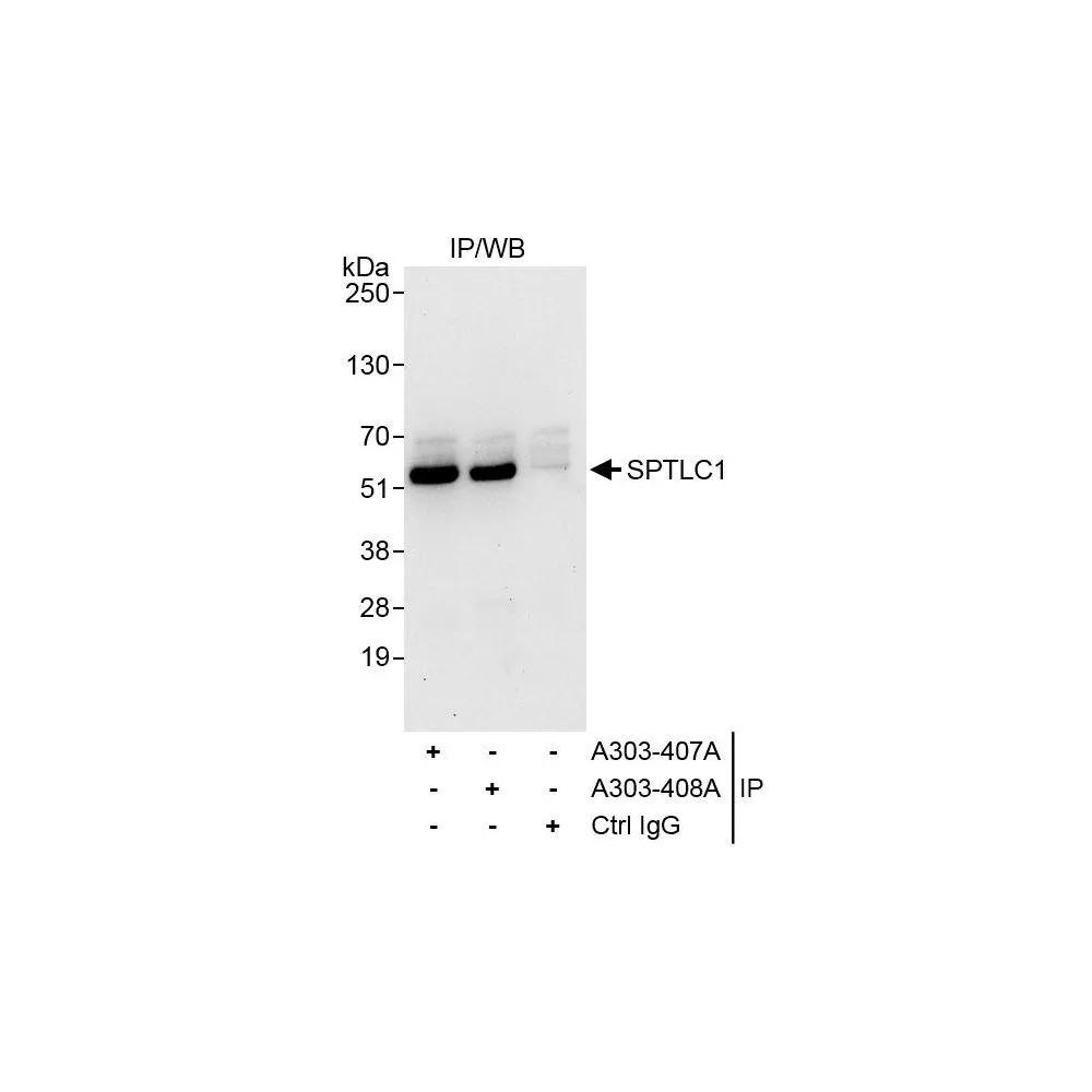 Rabbit anti-SPTLC1 Antibody, Affinity Purified