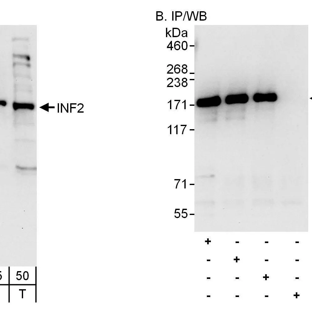 Rabbit anti-INF2 Antibody, Affinity Purified
