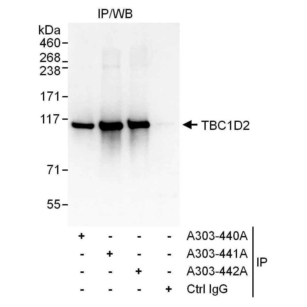 Rabbit anti-TBC1D2 Antibody, Affinity Purified