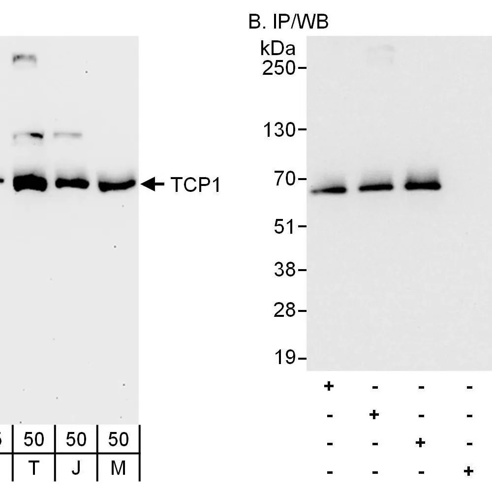 Rabbit anti-TCP1 Antibody, Affinity Purified