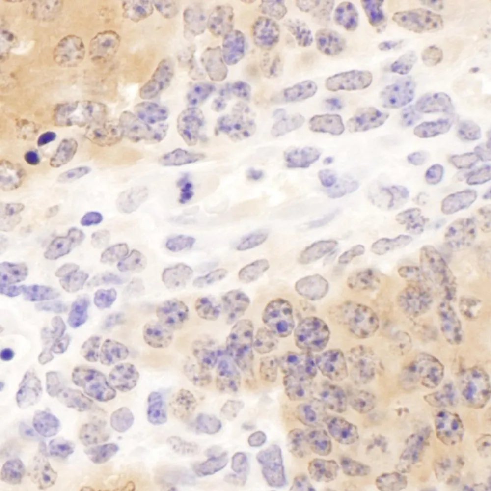 Rabbit anti-CCT8 Antibody, Affinity Purified