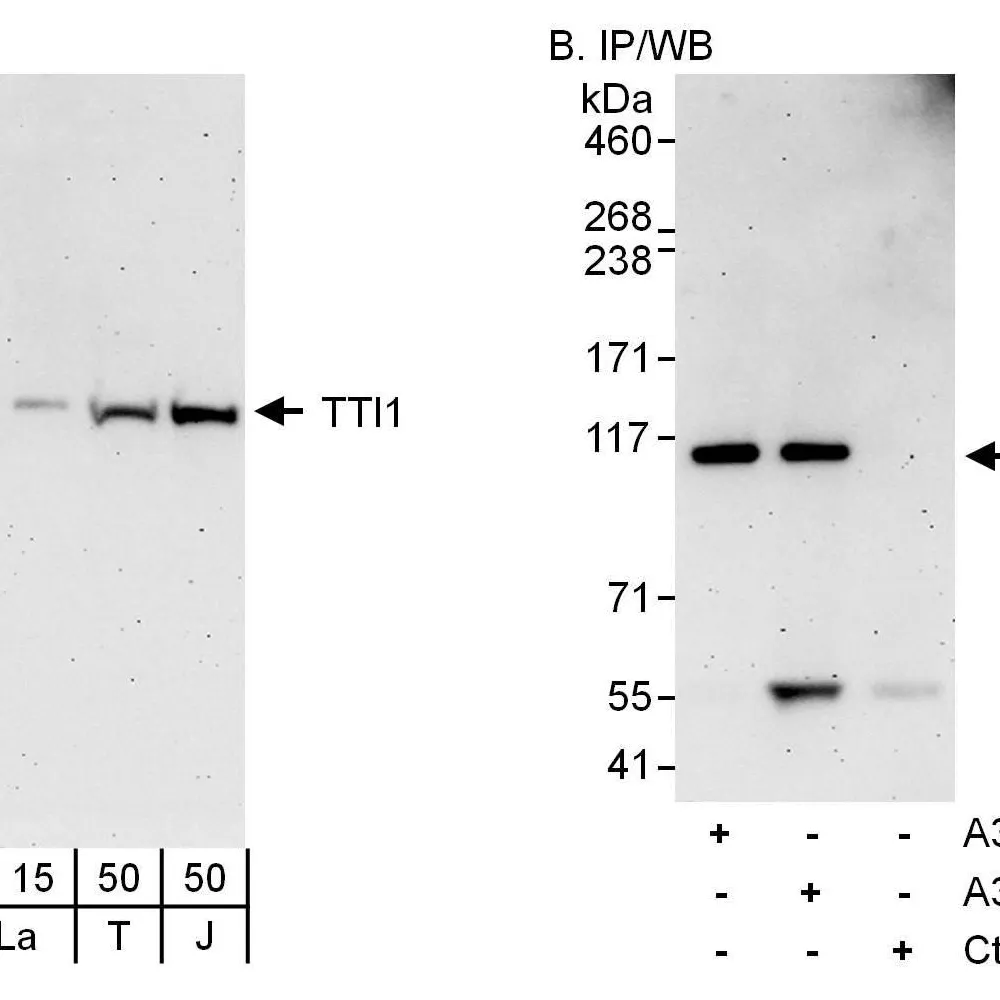 Rabbit anti-TTI1 Antibody, Affinity Purified