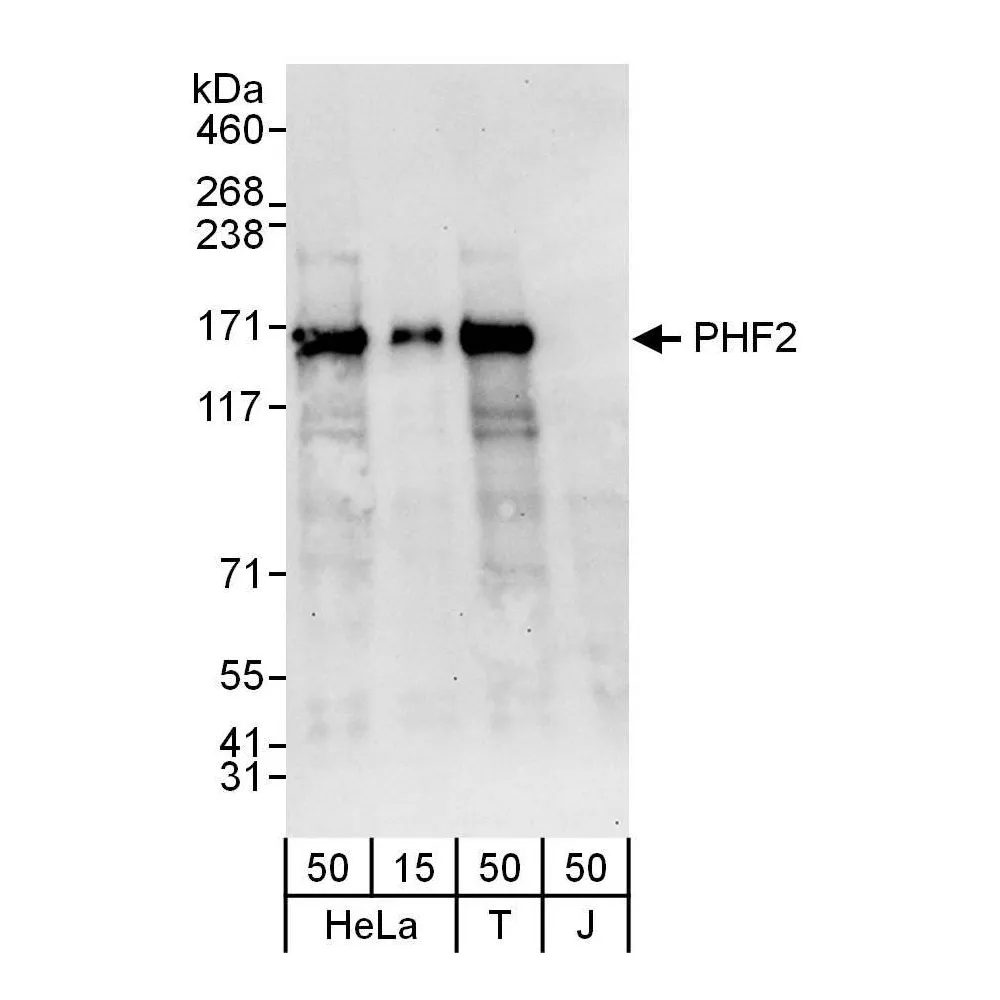 Rabbit anti-PHF2 Antibody, Affinity Purified