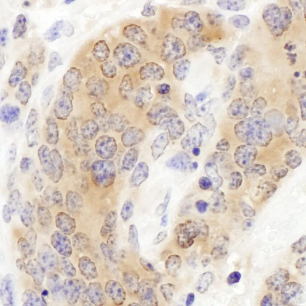 Rabbit anti-CCT3 Antibody, Affinity Purified