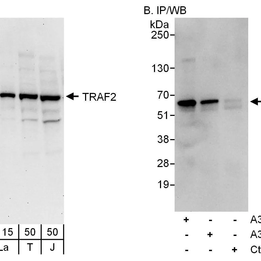 Rabbit anti-TRAF2 Antibody, Affinity Purified
