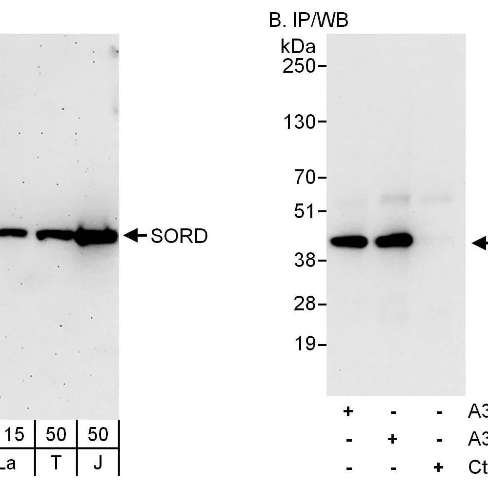 Rabbit anti-SORD Antibody, Affinity Purified