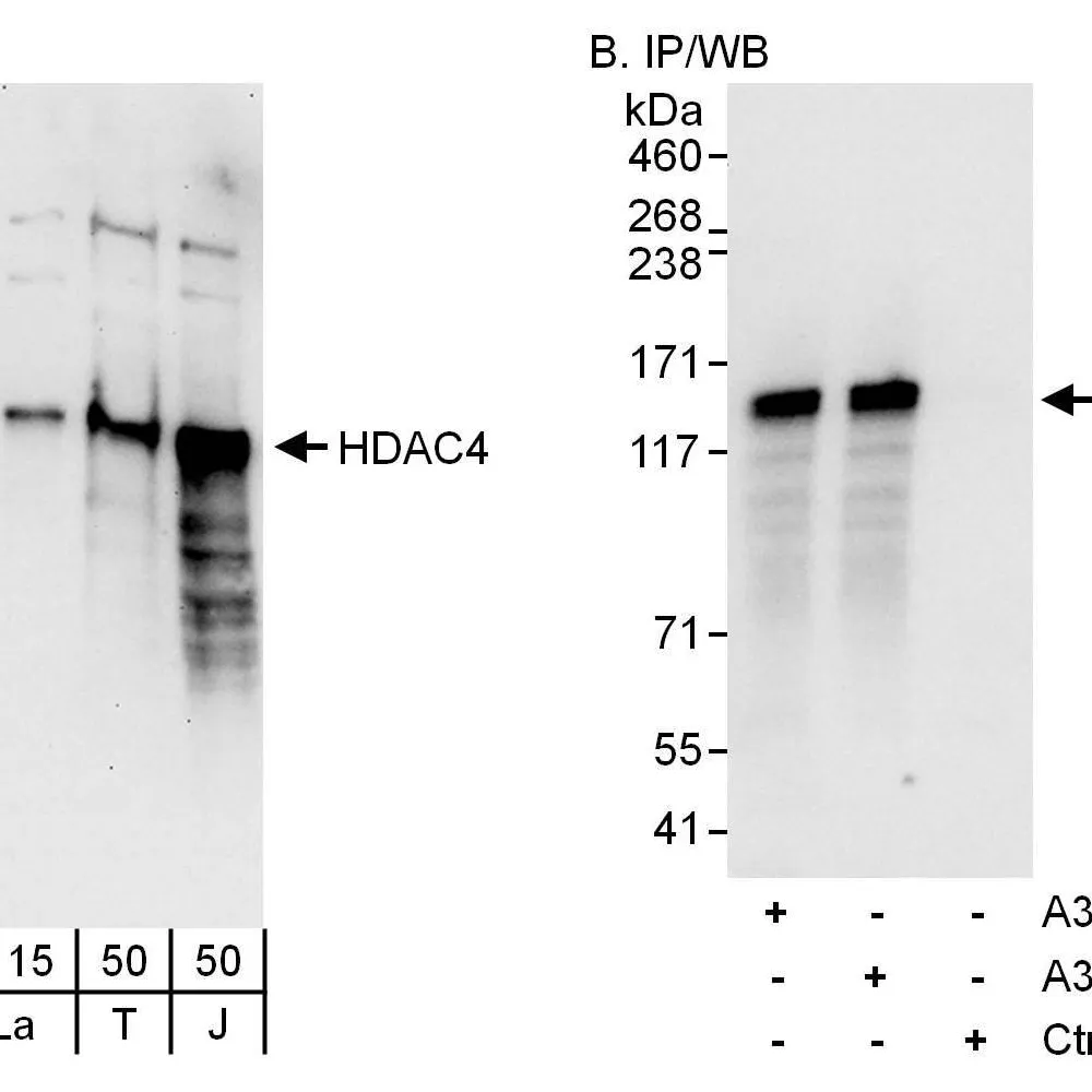 Rabbit anti-HDAC4 Antibody, Affinity Purified
