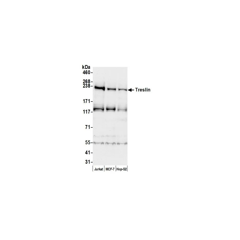 Rabbit anti-Treslin Antibody, Affinity Purified