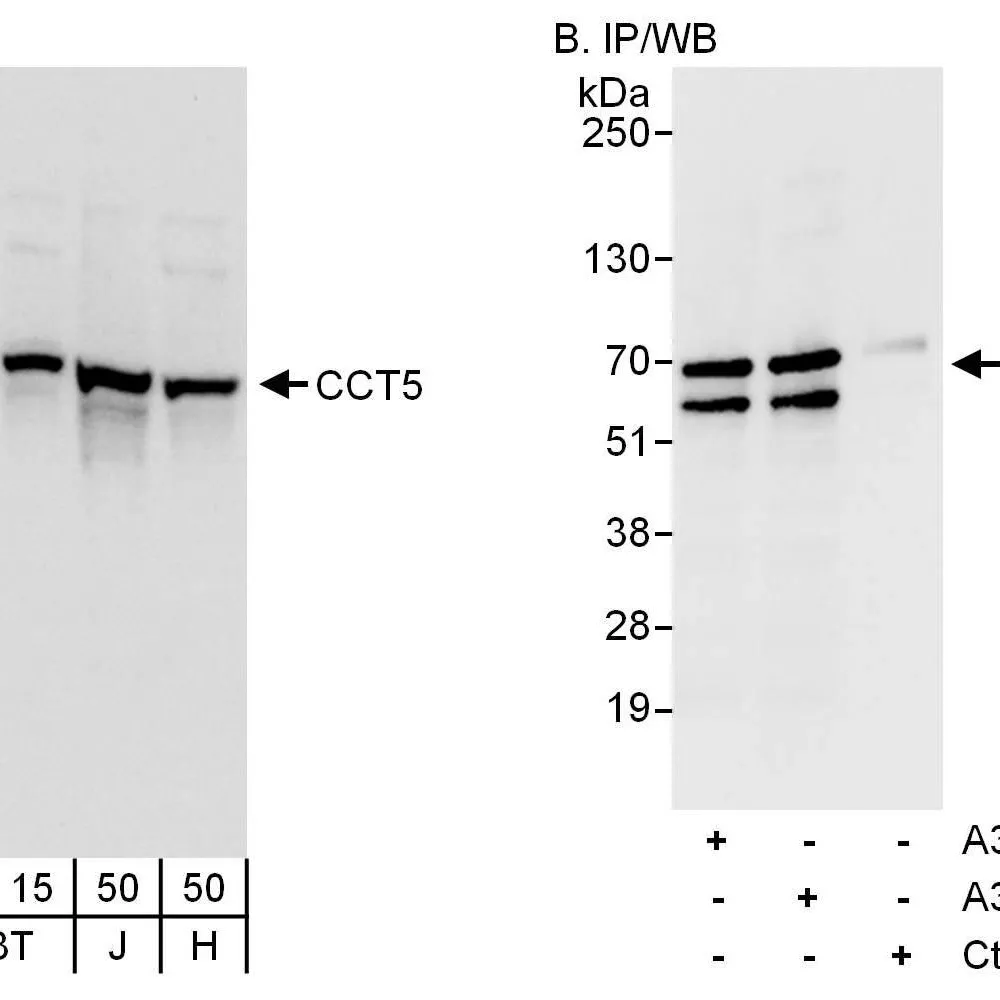 Rabbit anti-CCT5 Antibody, Affinity Purified