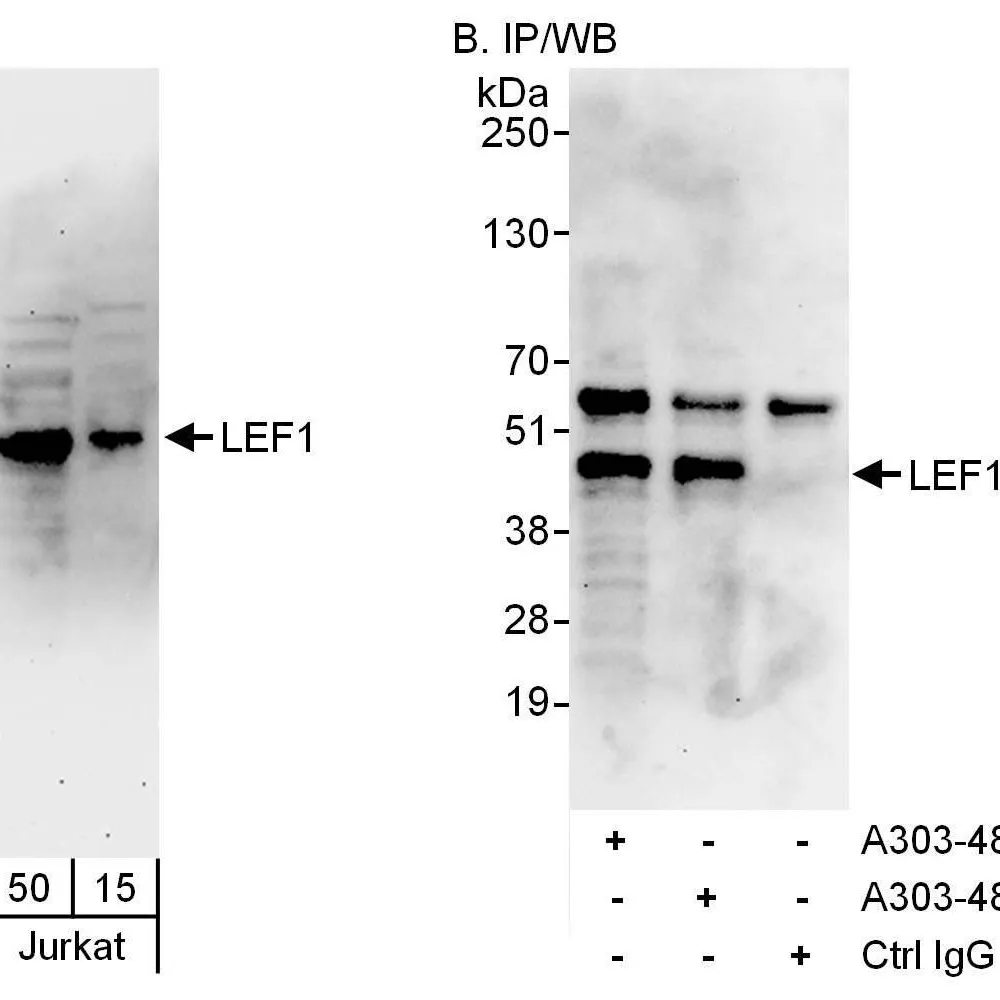 Rabbit anti-LEF1 Antibody, Affinity Purified