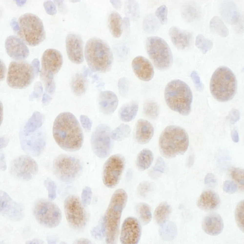 Rabbit anti-CDK9 Antibody, Affinity Purified
