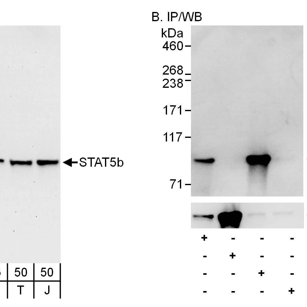 Rabbit anti-STAT5b Antibody, Affinity Purified