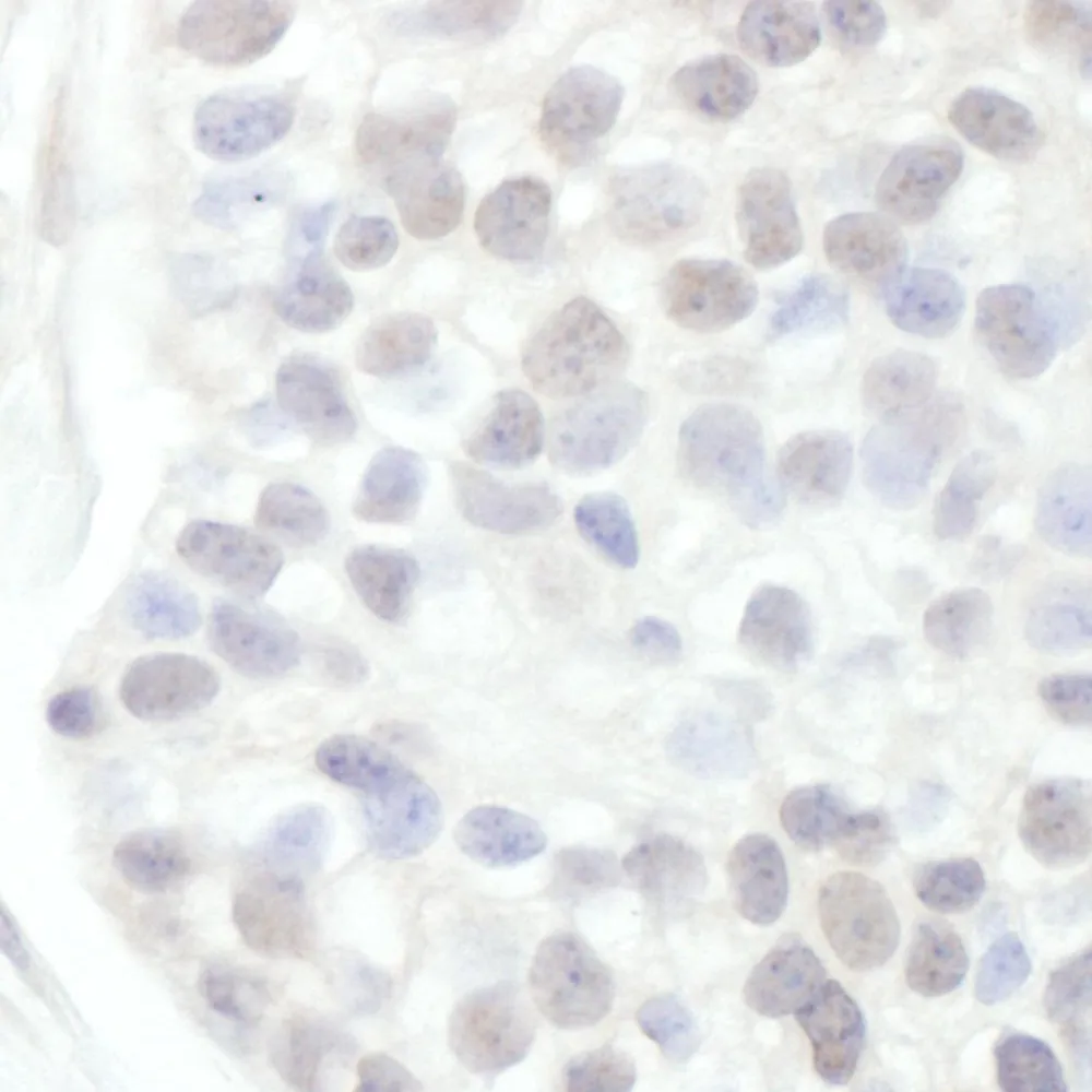 Rabbit anti-Cyclin T1 Antibody, Affinity Purified