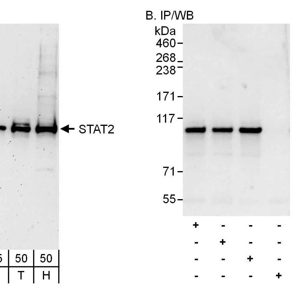 Rabbit anti-STAT2 Antibody, Affinity Purified
