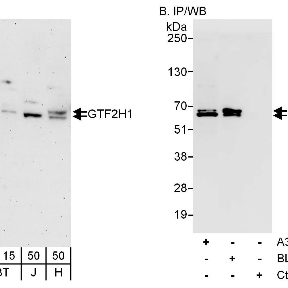 Rabbit anti-GTF2H1 Antibody, Affinity Purified