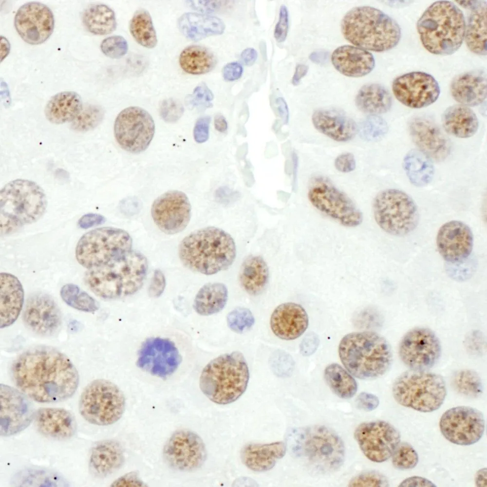 Rabbit anti-MEF2D Antibody, Affinity Purified