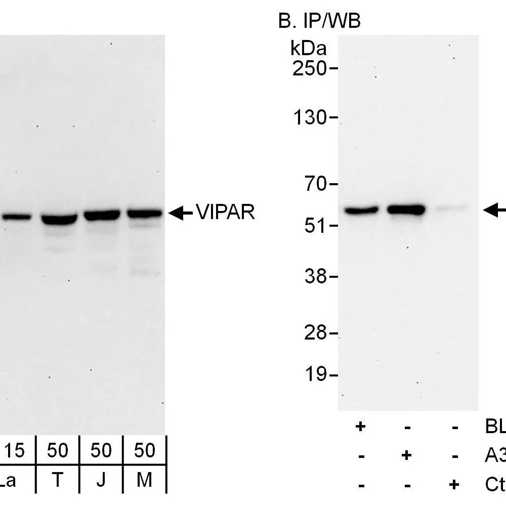 Rabbit anti-VIPAR Antibody, Affinity Purified