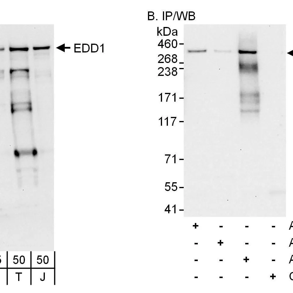 Rabbit anti-EDD1 Antibody, Affinity Purified