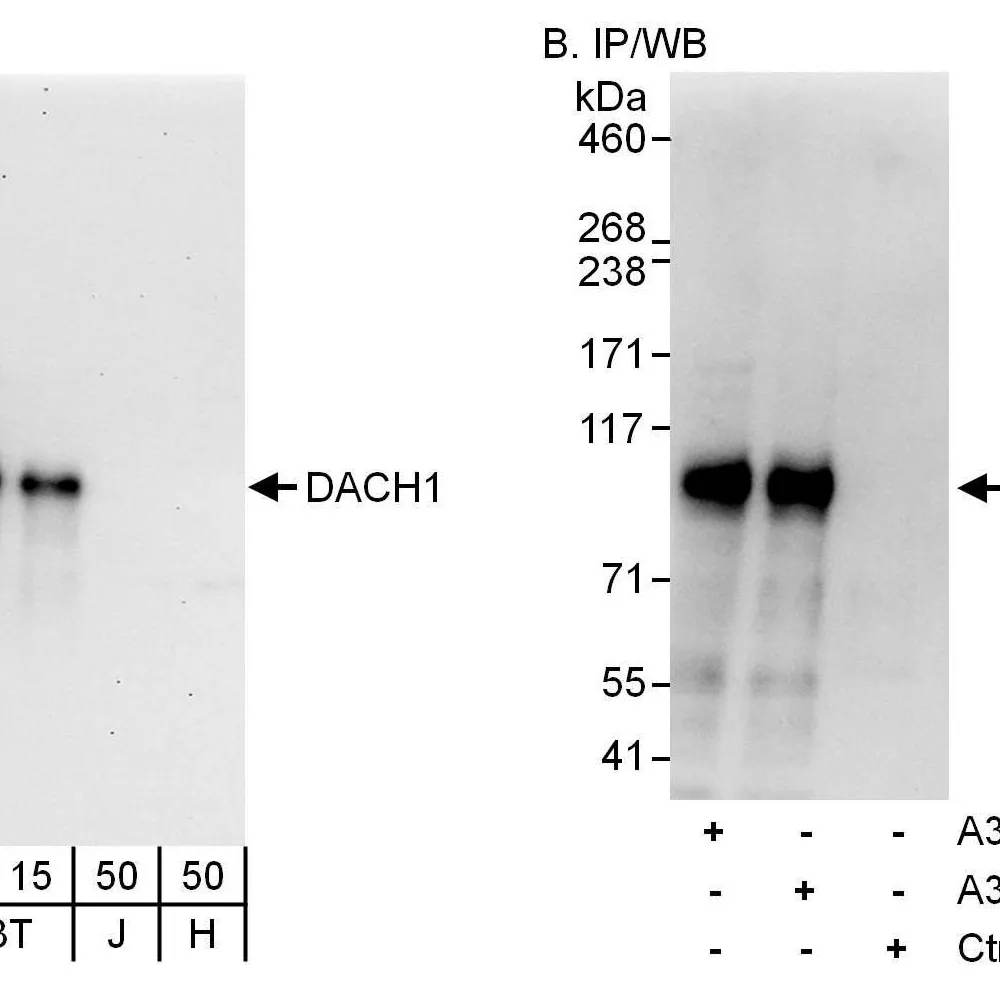 Rabbit anti-DACH1 Antibody, Affinity Purified