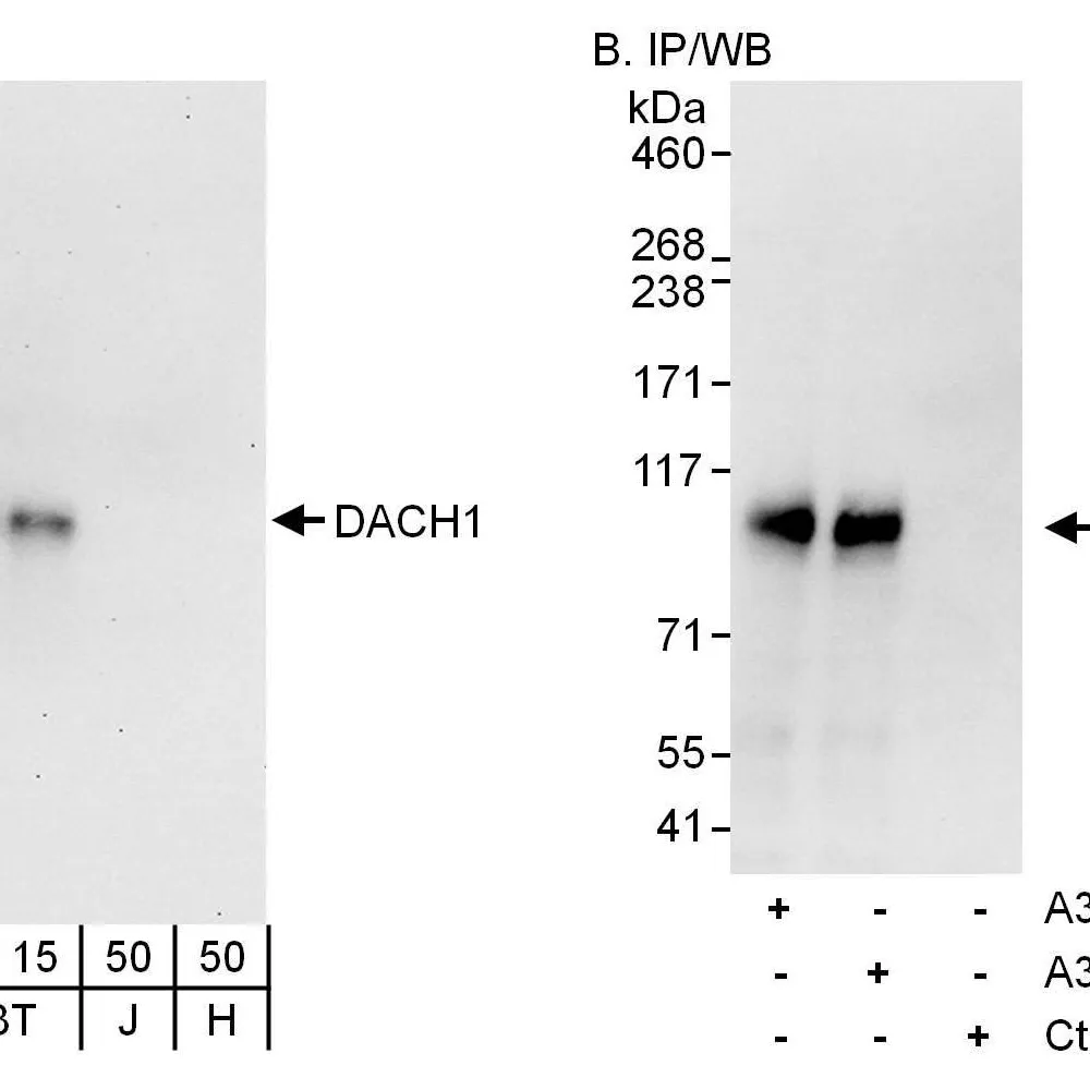 Rabbit anti-DACH1 Antibody, Affinity Purified