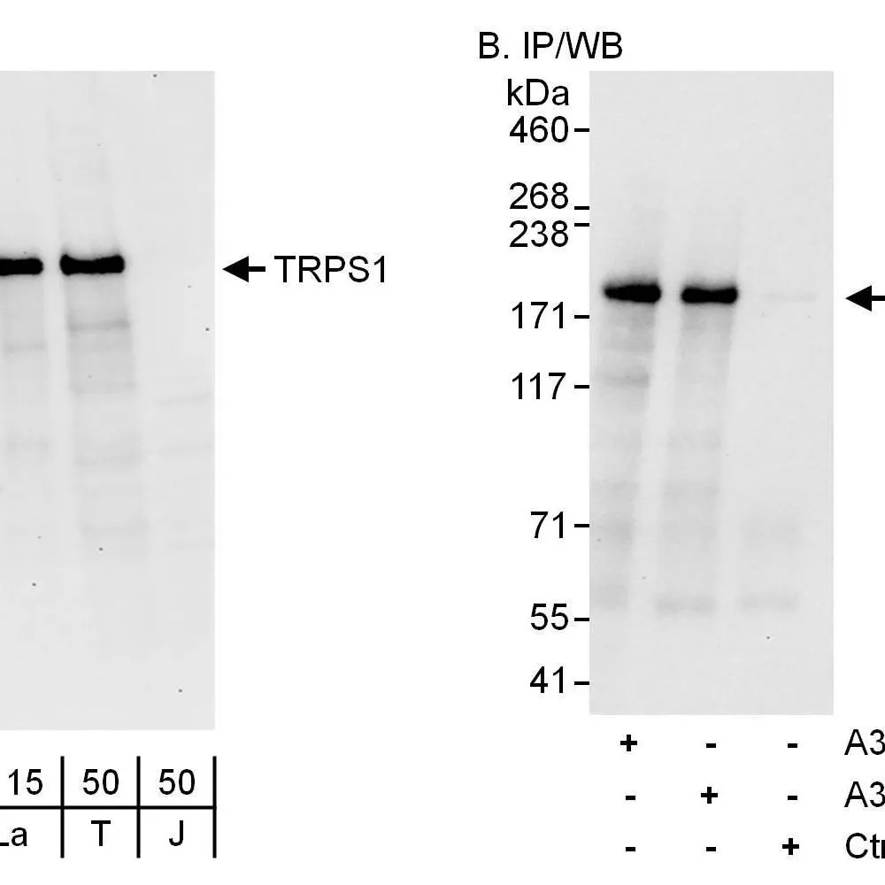 Rabbit anti-TRPS1 Antibody, Affinity Purified