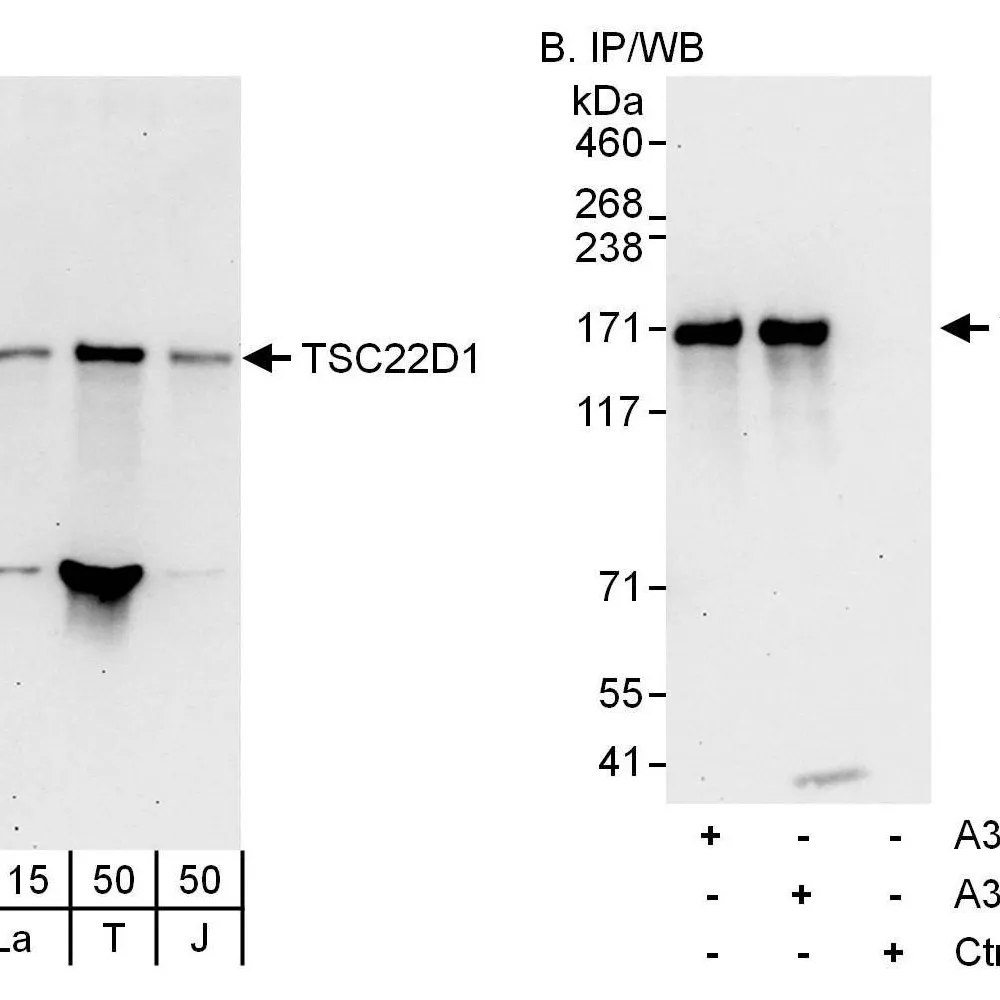 Rabbit anti-TSC22D1 Antibody, Affinity Purified