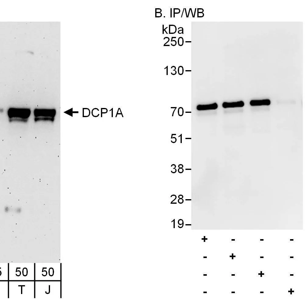 Rabbit anti-DCP1A Antibody, Affinity Purified