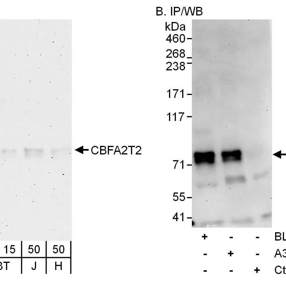 Rabbit anti-CBFA2T2 Antibody, Affinity Purified
