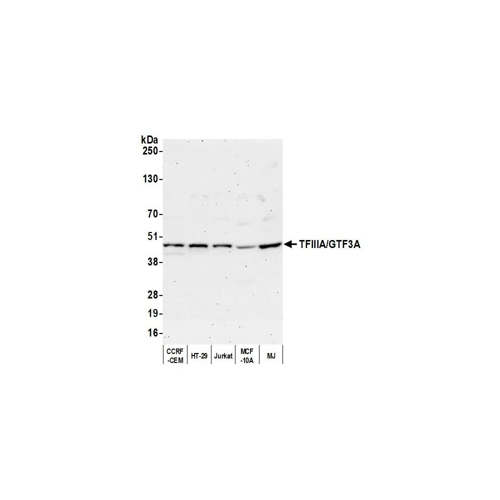 Rabbit anti-TFIIIA/GTF3A Antibody, Affinity Purified