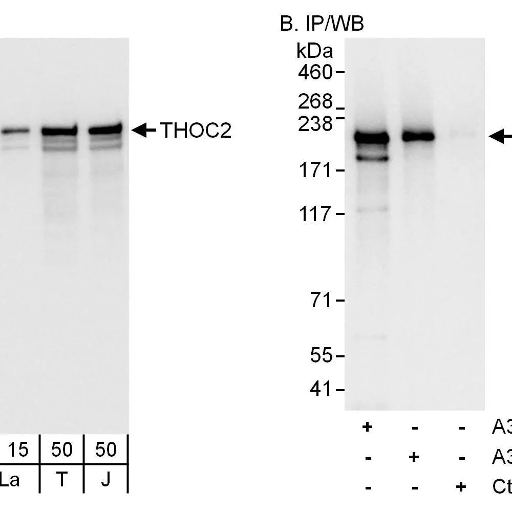 Rabbit anti-THOC2 Antibody, Affinity Purified