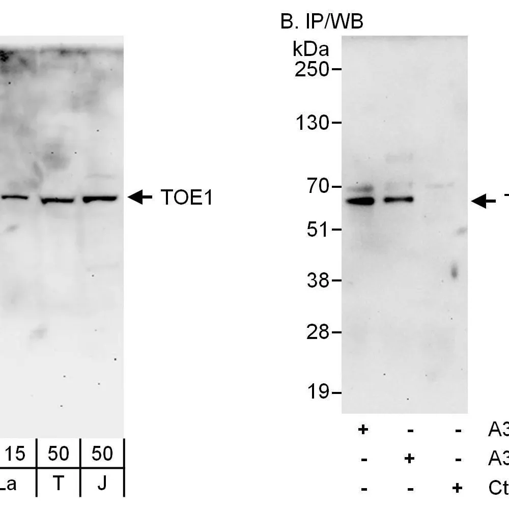 Rabbit anti-TOE1 Antibody, Affinity Purified