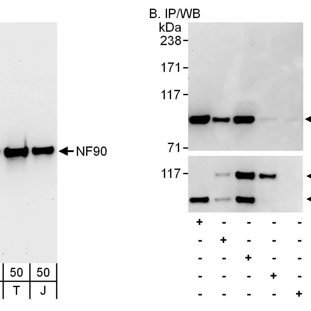 Rabbit anti-NF90 Antibody, Affinity Purified