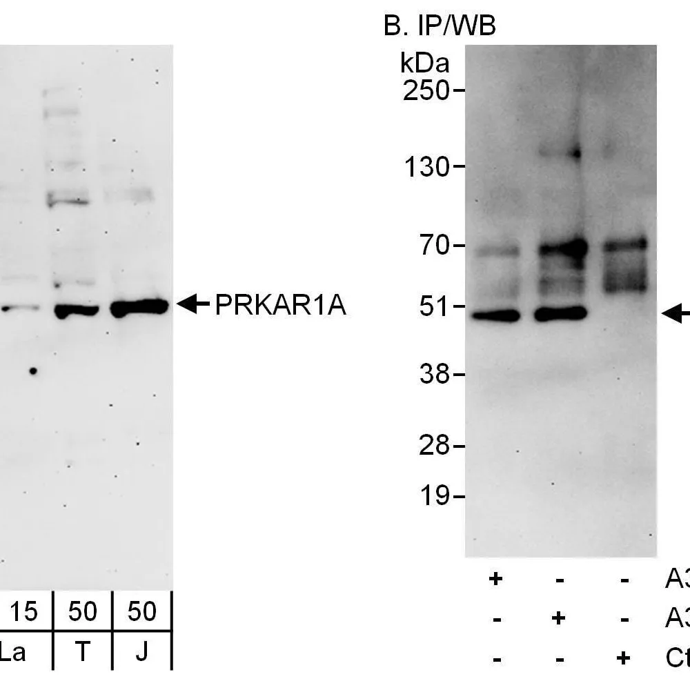 Rabbit anti-PRKAR1A Antibody, Affinity Purified